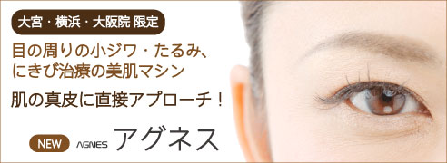 アグネス_492×180