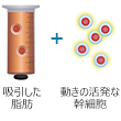 セリューション乳房再建術（脂肪由来幹細胞移植）